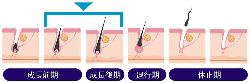 脱毛マシンの特徴