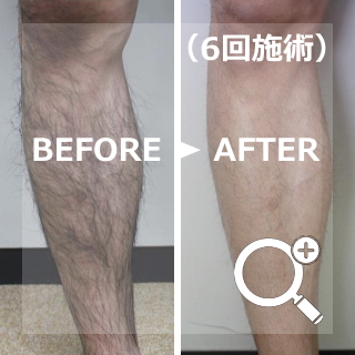 Before After